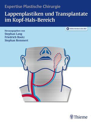 cover image of Lappenplastiken und Transplantate im Kopf-Hals-Bereich